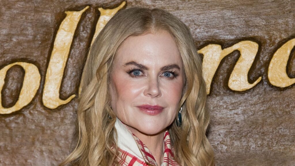 Nicole Kidman revela la próxima criatura sin pelo que podría bienvenida a la familia