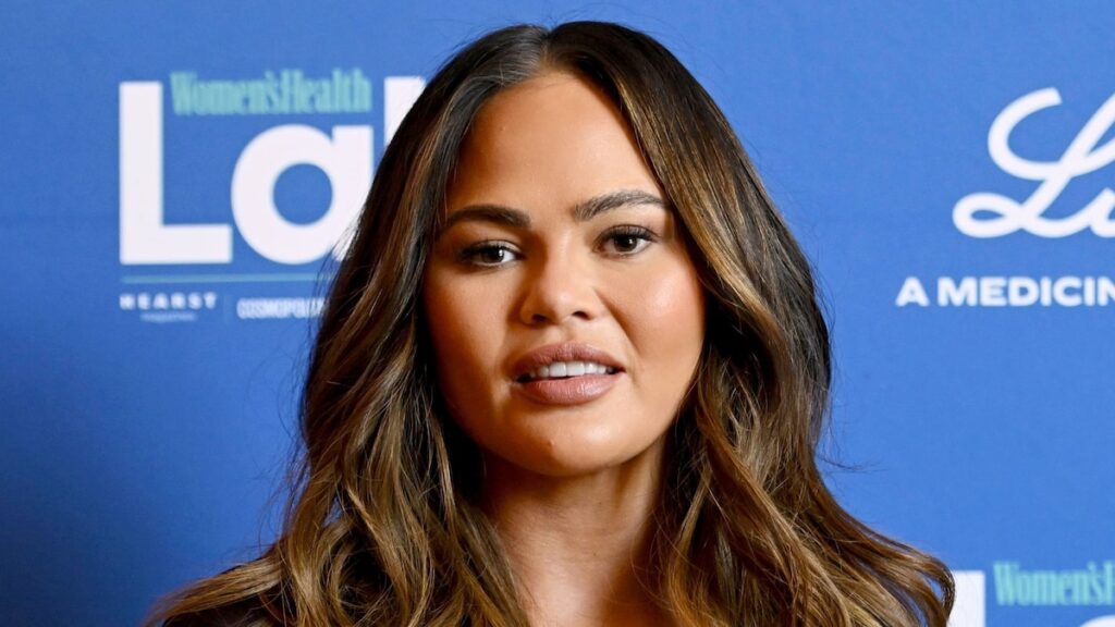 Chrissy Teigen se pone en marcha con una cara de vendada impactante y no explica nada