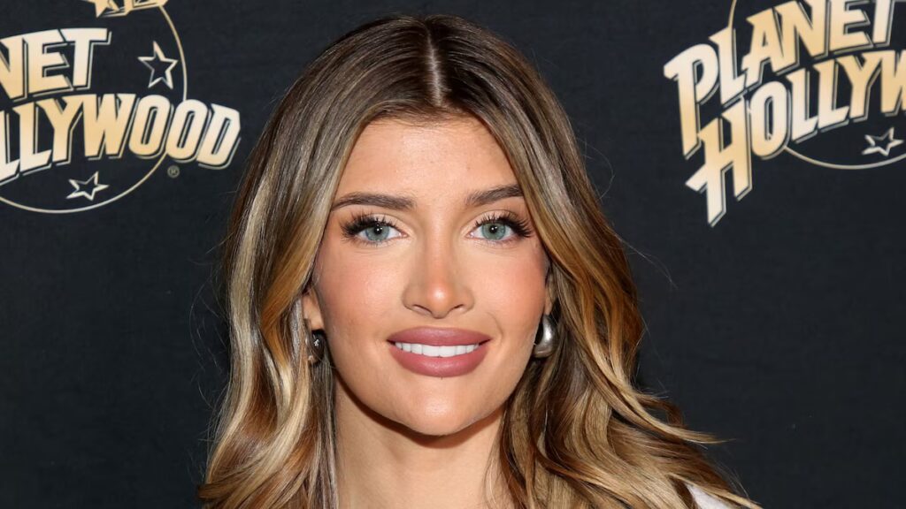 Sami Sheen comparte un antes y un después de sus cirugías plásticas y trabajos estéticos