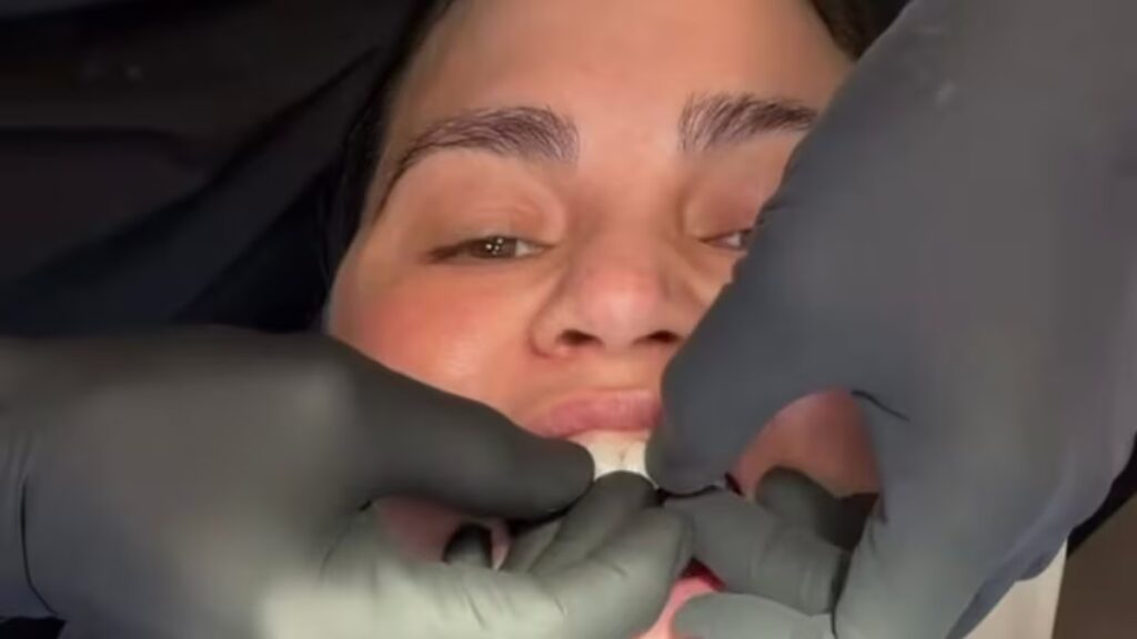 A Chrissy Teigen le vuelven a poner el diente después de que el proyecto del bastón de caramelo saliera terriblemente mal