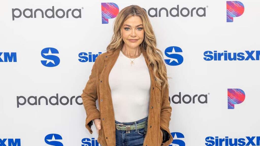 Denise Richards comparte fotos detrás de escena de su estiramiento facial