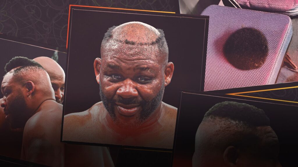Jarrell Miller y un regreso viral impulsado por un peluquín