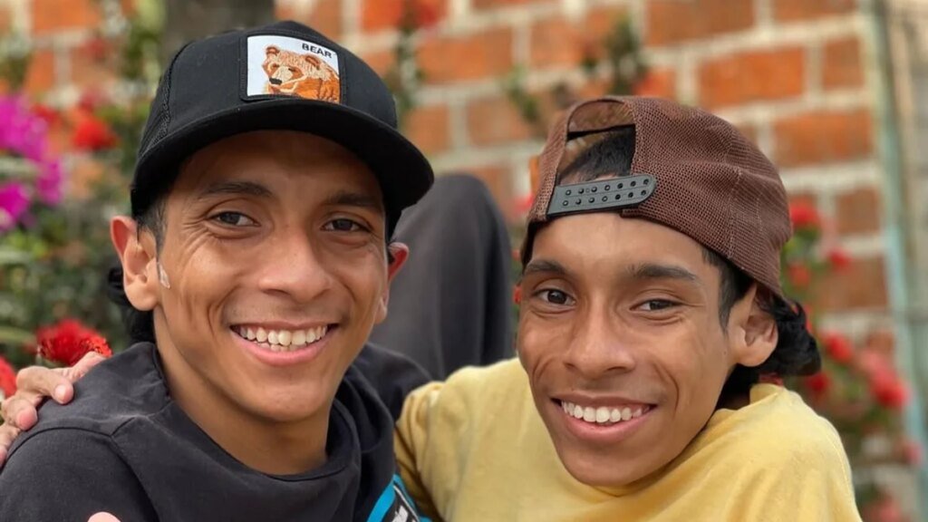 Se desvela la causa de la muerte de los siameses José Luis y José Armando a los 27 años: un infarto acabó con la vida de ambos